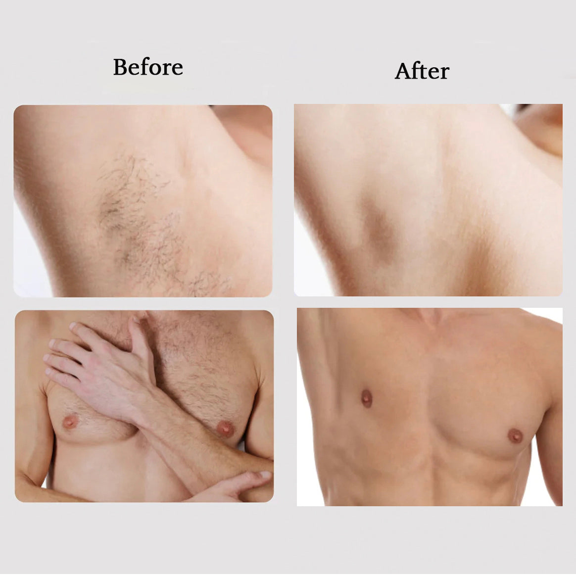 M1 Sapphire IPL Hair Removal Handset