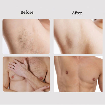 M1 Sapphire IPL Hair Removal Handset